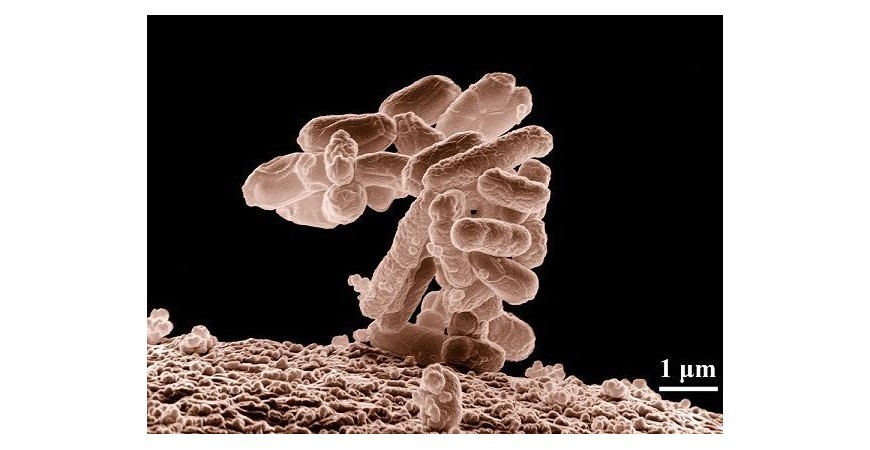Presencia de bacterias coliformes en el agua de pozo