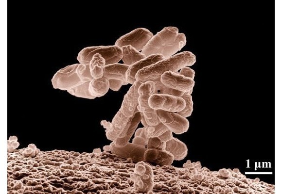 Presencia de bacterias coliformes en el agua de pozo